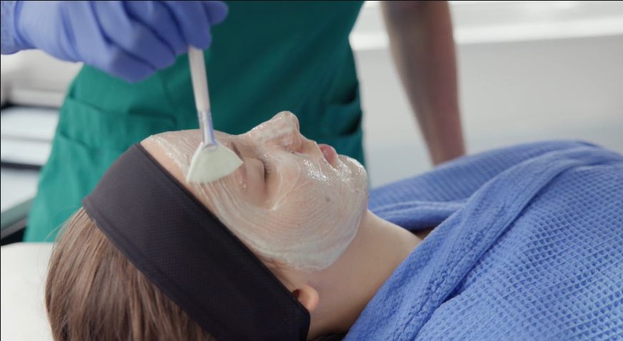 A chemical peel