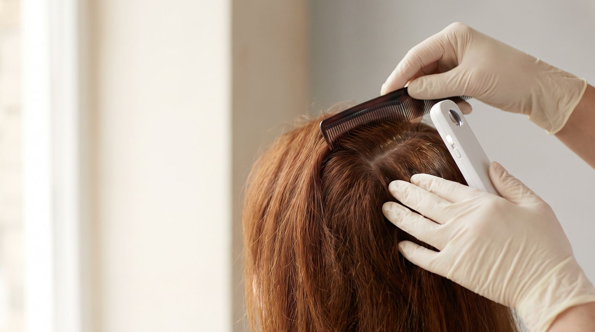 Gloved hands parting auburn hair with a comb and a scalp scope at the crown
