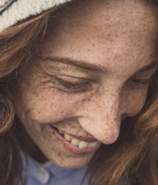 Woman with freckled skin | Meyer Clinic