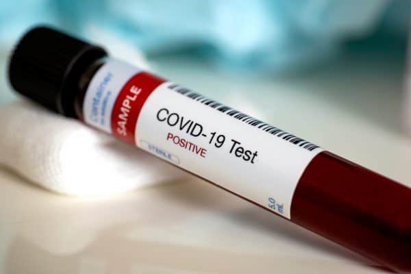 A vial marked COVID-19 Test with Positive displayed highlights recent Covid-19 detection. - Meyer Clinic