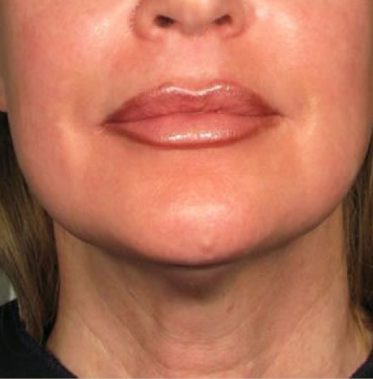 a close-up of a woman's face